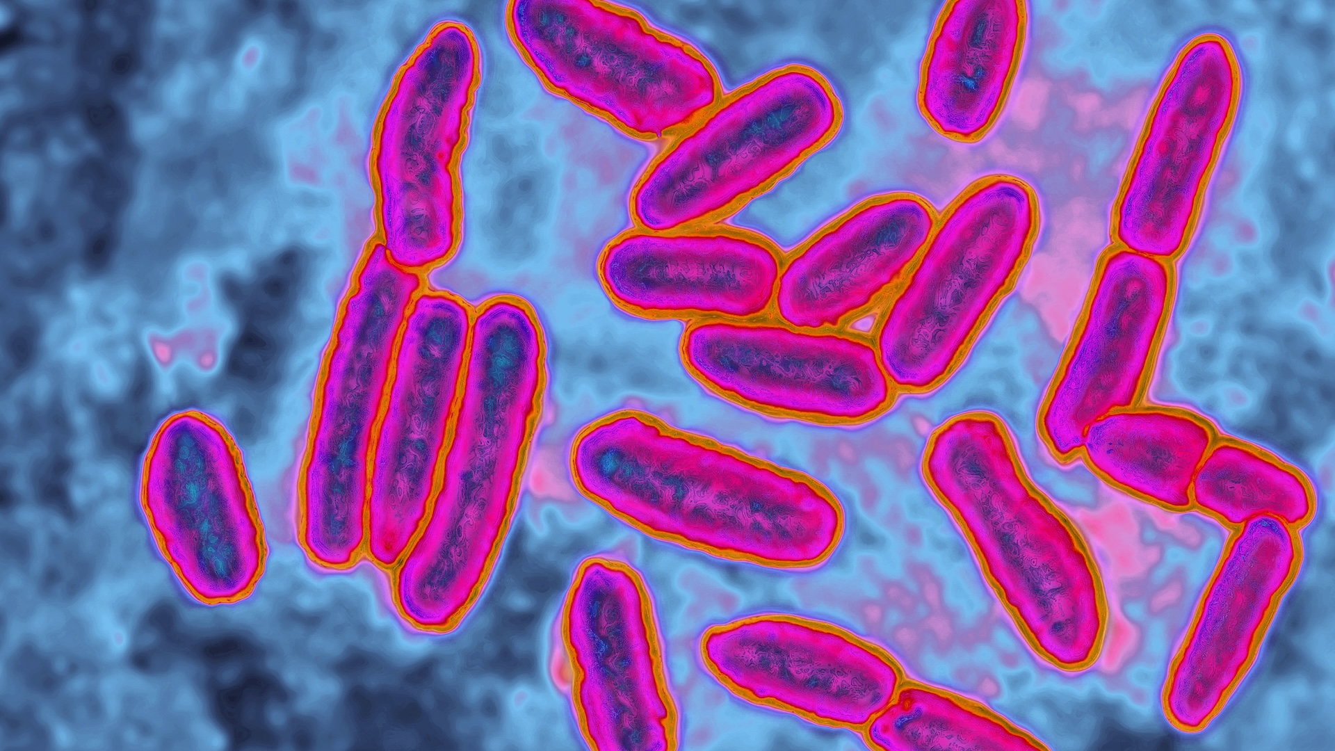Antibiotic resistance makes once-lifesaving drugs useless. Could we reverse
