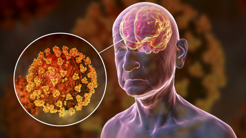 Virus that causes COVID-19 uses a secret ‘back door’ to infect the brain