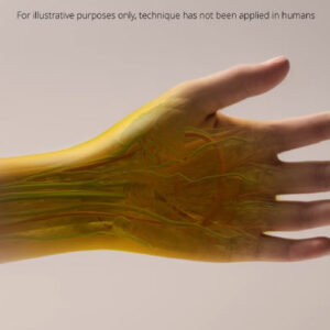 Common Food Dye Makes Skin, Muscle Reversibly Transparent in Live Animals