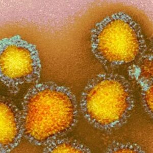 Bird flu strikes 1st child in the US — CDC says infection source unknown