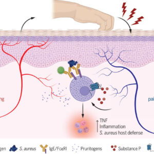 Scratching an Itch Promotes Allergic Inflammation, Study Shows