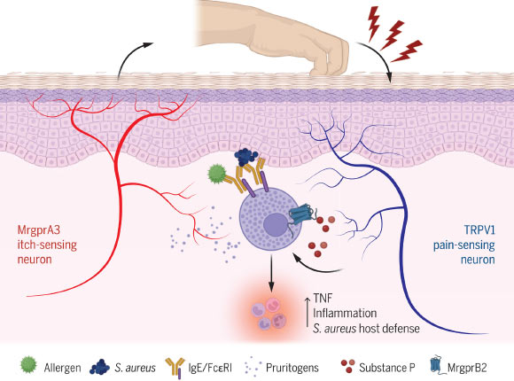 Scratching an Itch Promotes Allergic Inflammation, Study Shows