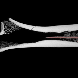 7,000-year-old bone holds 3 arrowheads with mixed poisons — the oldest of their kind on record