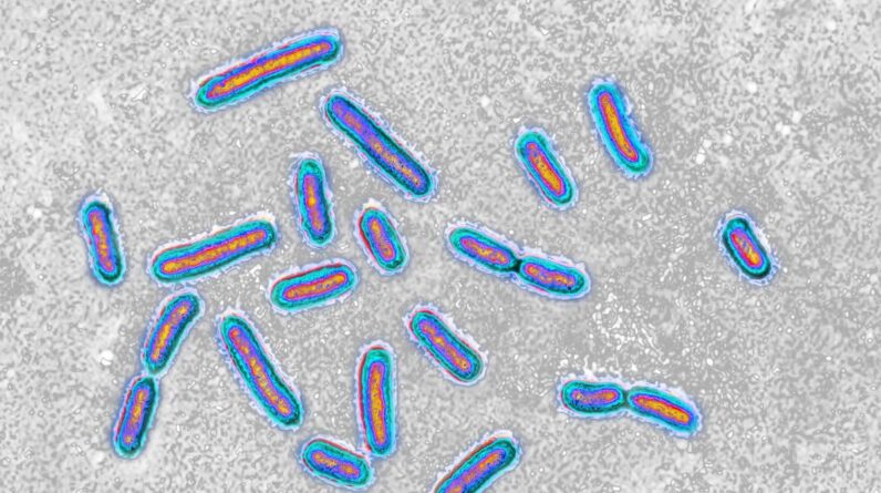 Hospital superbug can feed on medical plastic, first-of-its-kind study reveals