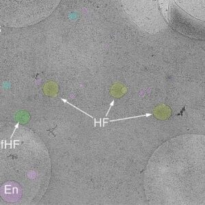 Hemifusomes: Biologists Discover Previously Unknown Organelle Complexes inside Human Cells