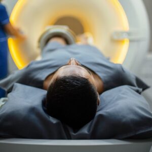 What are whole-body MRIs, and are they worth the hype?