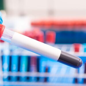 New blood test detects cancers 3 years before typical diagnosis, study hints