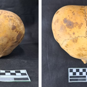 ‘Alien’ skull of toddler is actually evidence of long-standing practice of head shaping