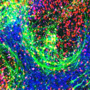 New pocket-size model of ALS ‘breathes and flows like human tissue’