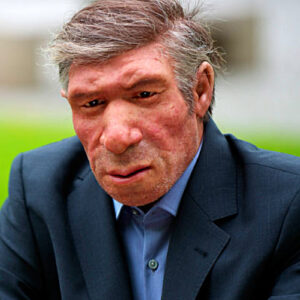 Serious Neurological Condition May Be Linked to Neanderthal Genes