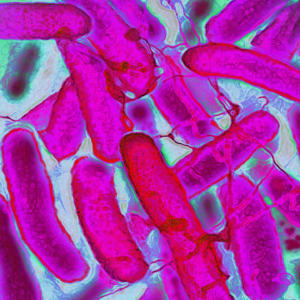 Caffeine may help E. coli resist antibiotics — but more research is needed