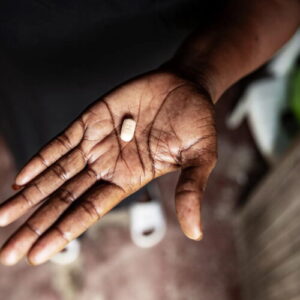 Five children see HIV viral loads vanish after taking antiretroviral drugs