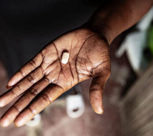 Five children see HIV viral loads vanish after taking antiretroviral drugs