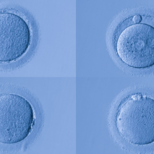Human eggs have special protection against certain types of aging, study hints