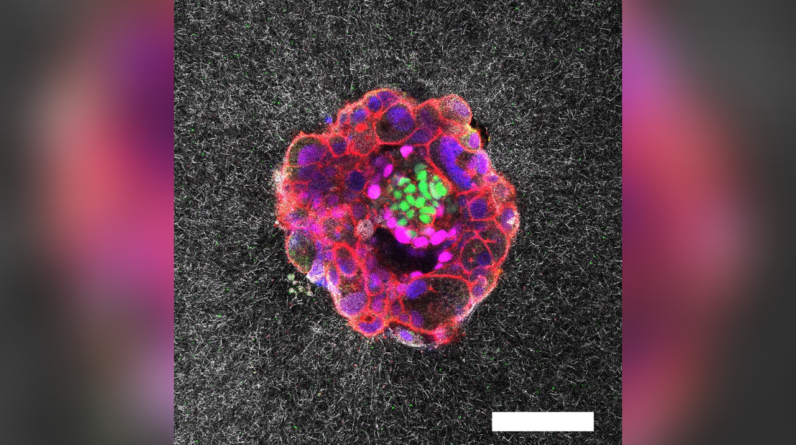 Incredible, first-of-its-kind video shows human embryo implanting in real time