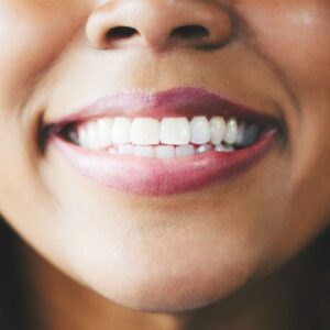 Keratin extracted from sheep’s wool repairs teeth in breakthrough