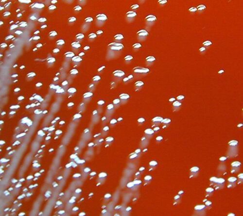 Two men fell gravely ill last year; their infections link to deaths in the โ80s