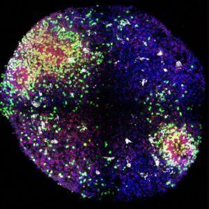 ‘Minibrains’ reveal secrets of how key brain cells form in the womb