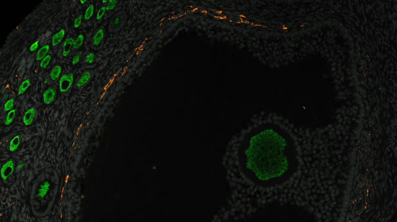 We finally have an idea of how the lifetime supply of eggs develops in primates