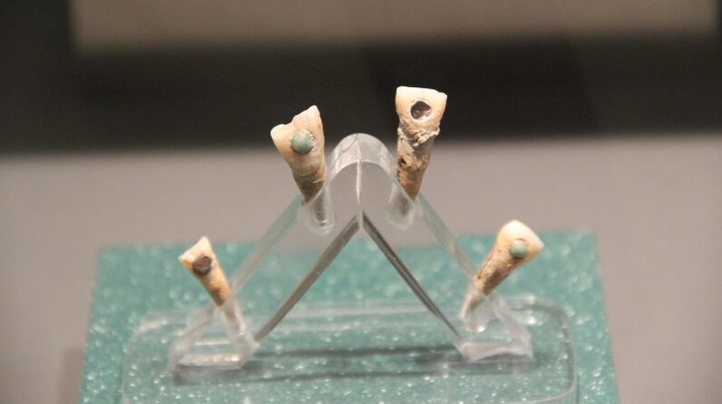 7-year-old Maya child had green jade ‘tooth gem,’ new study finds