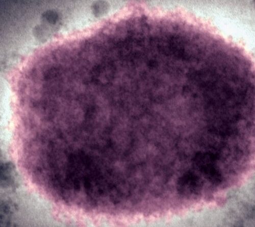 In 2022, the world axed a disease name seen as racist. US just switched back.