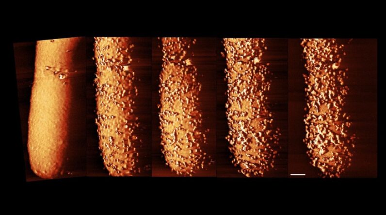 Striking images capture an antibiotic slaying bacteria in real time