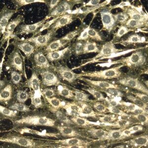 Chemo hurts both cancerous and healthy cells. But scientists think nanoparticles could help fix that.