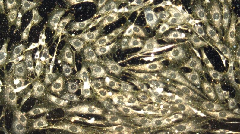 Chemo hurts both cancerous and healthy cells. But scientists think nanoparticles could help fix that.