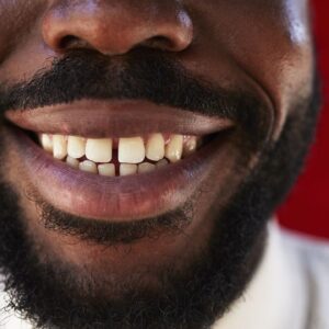 Mysterious chunks of DNA called ‘inocles’ could be hiding in your mouth