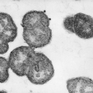 Diagnostic dilemma: A toddler accidently ate gonorrhea bacteria from a lab dish
