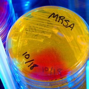 Antibiotic found hiding in plain sight could treat dangerous infections, early study finds