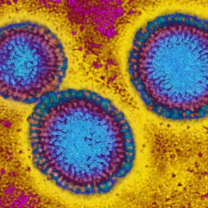 This flu season looks grim as H3N2 emerges with mutations