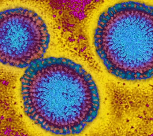 This flu season looks grim as H3N2 emerges with mutations