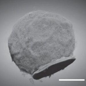 Tiny chips hitch a ride on immune cells to sites of inflammation