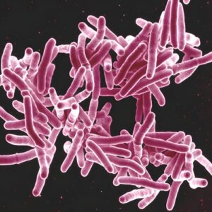 Why you don’t want to get tuberculosis on your penis