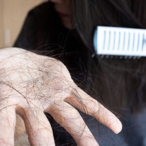 We may finally understand stress-induced hair loss