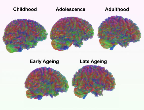 Neuroscientists Identify Five Major Epochs of Brain Structure over Course of Human Life
