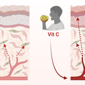 Collagen Production and Skin Renewal Directly Respond to Amount of Vitamin C We Consume: Study