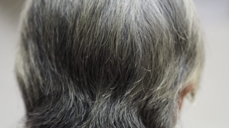 Gray hair may have evolved as a protection against cancer, study hints