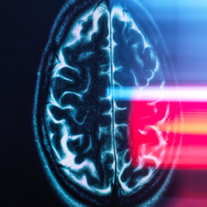 Brain scans reveal ‘dial’ that helps keep us from getting lost