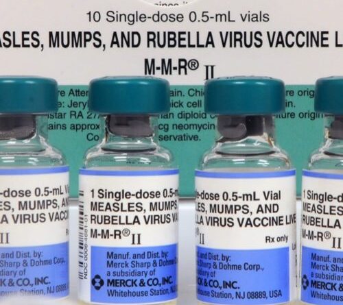 SC measles outbreak has gone berserk: 124 cases since Friday, 409 quarantined