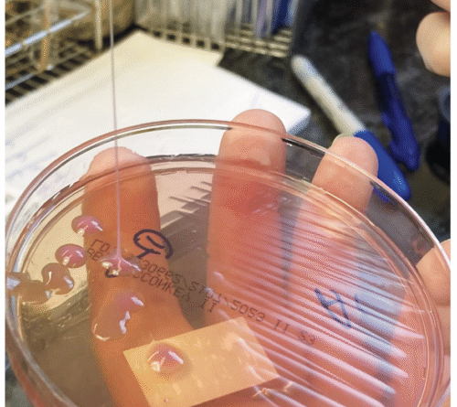 This may be the grossest eye pic ever—but the cause is what’s truly horrifying