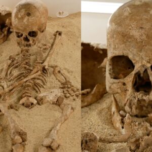 Teenage girl who lived in Italy 12,000 years ago had a rare form of dwarfism, DNA study shows