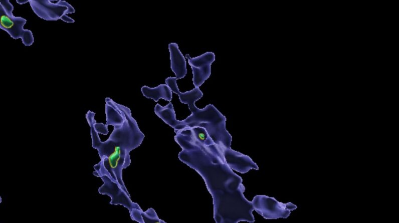 Microplastics that accumulate in the body may ‘clog up’ immune cells