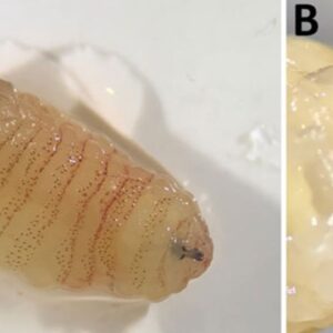Diagnostic dilemma: Woman’s ‘biologically implausible’ infection led her to sneeze ‘worms’ out of her nose