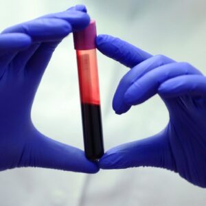 New blood test aims to spot liver scarring before it paves the way to cancer