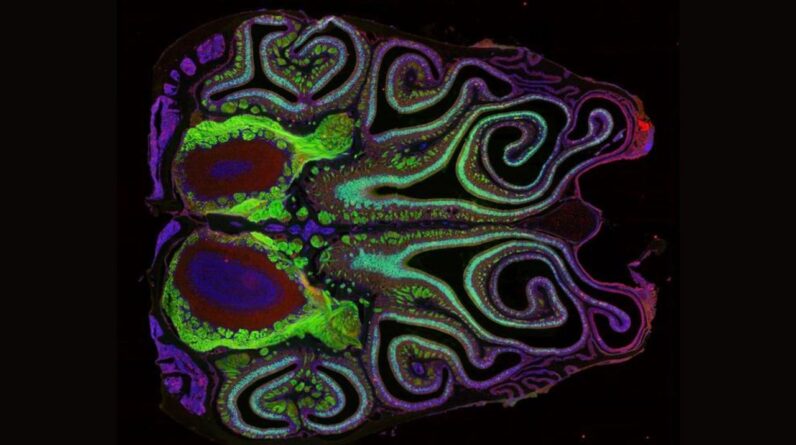 First-of-its-kind map of the mouse nose reveals surprises about the sense of smell