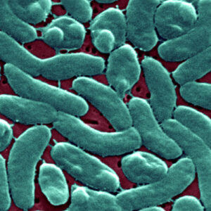 Flesh-eating bacteria devour man’s arm and leg in just three days