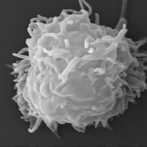 Man dies covered in necrotic lesions after amoebas eat him alive