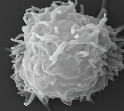 Man dies covered in necrotic lesions after amoebas eat him alive